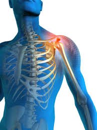 Thoracic Outlet Syndrome Treatment in Delhi